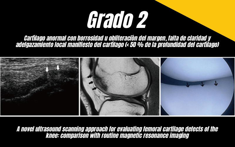 5. Ecografia Tempo formacion Cartilago Femoral.png